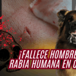 ¡Rabia humana cobra otra vida en México!