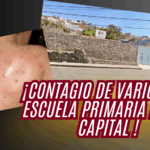 ¡Brote de varicela en escuela primaria de Guanajuato!