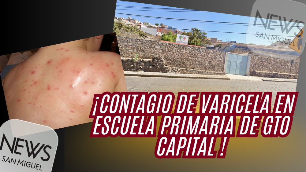 ¡Brote de varicela en escuela primaria de Guanajuato!