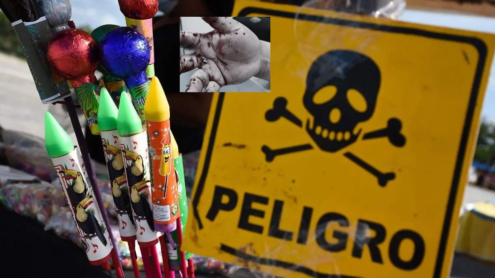 En San Miguel de Allende, la pirotecnia también le voló los dedos al menos a 2